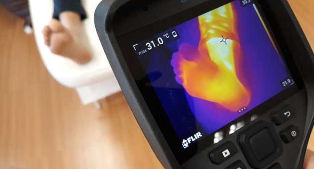 An innovative technological approach in diabetes foot care